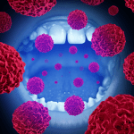 Oral Pathology microbes attacking the mouth
