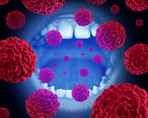 Oral Pathology microbes attacking the mouth