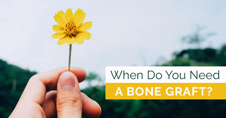 When do you need a bone graft text over a background of a hand holding a dandelion