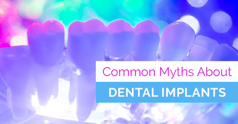 common myths about dental implants text in front of a fluorescent purple colored row of teeth
