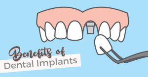 benefits of dental implants title image mouth with missing tooth and implant being placed