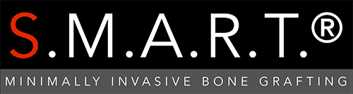 S.M.A.R.T. Minimally Invasive Bone Grafting Logo