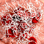 red blood cells caught in a fibrin mesh