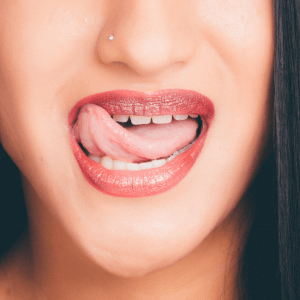 a frenectomy procedure can have many oral health benefits