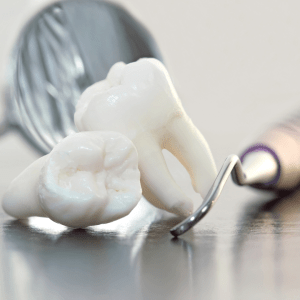 Wisdom teeth sitting on table next to dental instruments