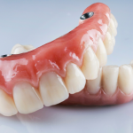 Full arch dental prosthesis