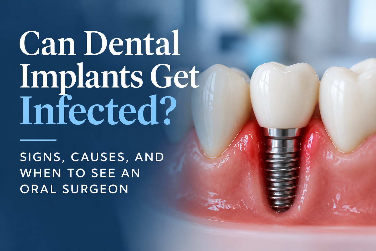 Can Dental implants get infected cover image with title and a digital model of gums showing an exposed dental implant with crown on top