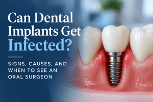 Can Dental implants get infected cover image with title and a digital model of gums showing an exposed dental implant with crown on top